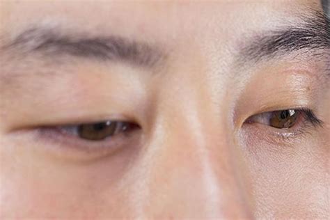 左眼眼袋一直跳是什么预兆,左下眼皮跳是什么预兆